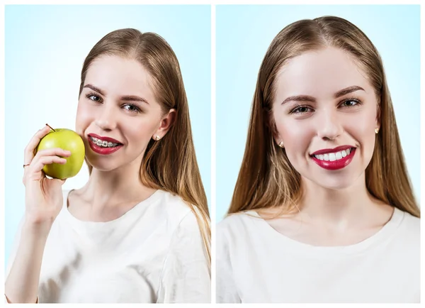 Giovane donna con staffe sui denti mangiare mela — Foto Stock