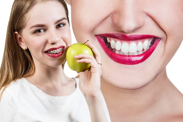 Giovane donna con staffe sui denti mangiare mela — Foto Stock