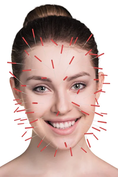 Close-up of performing acupuncture therapy on face — Stock Photo, Image