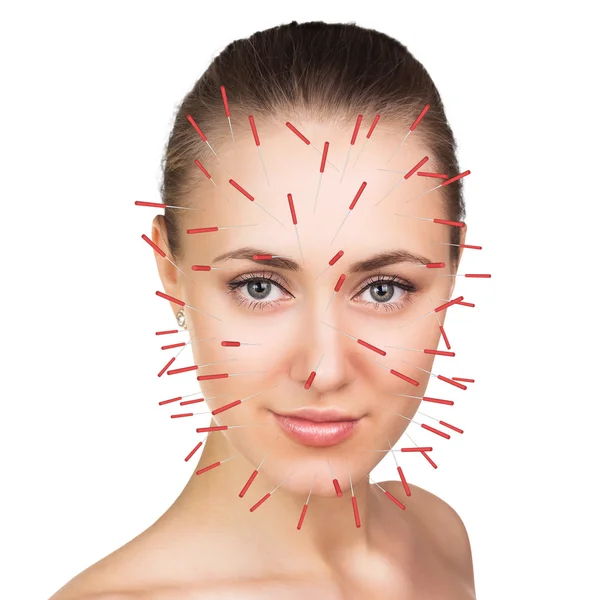 Primer plano de la realización de la terapia de acupuntura en la cara — Foto de Stock