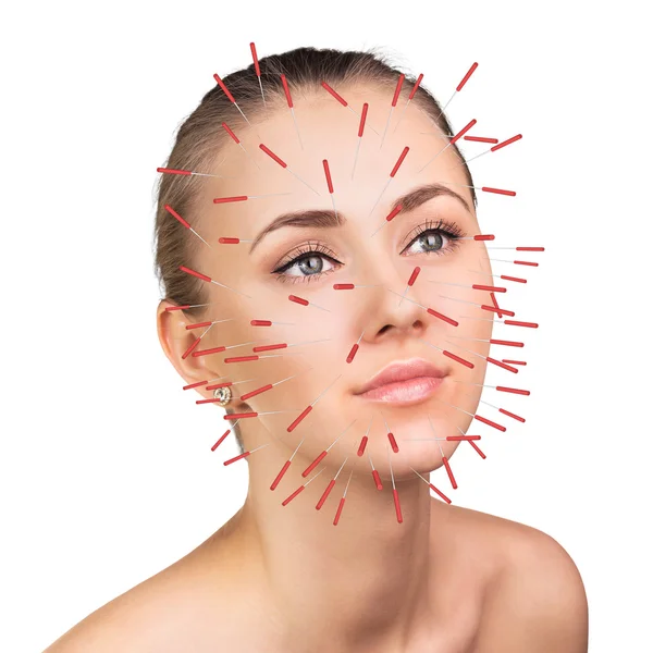 Primer plano de la realización de la terapia de acupuntura en la cara — Foto de Stock