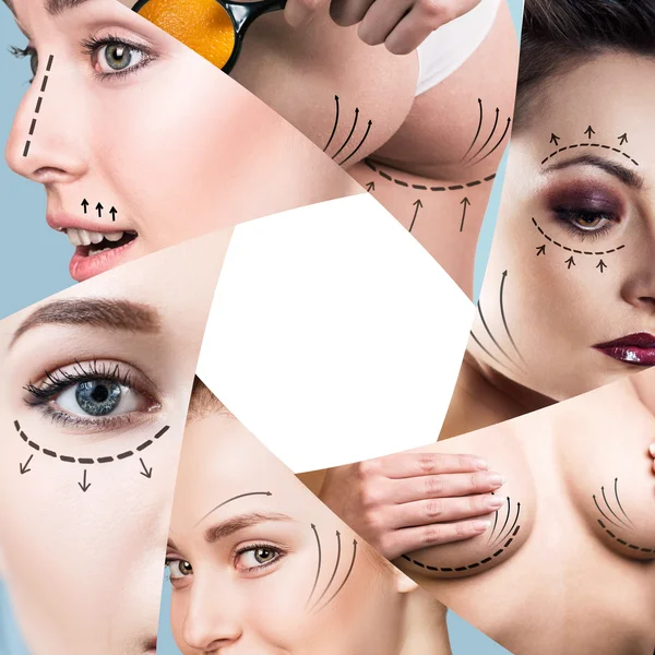 Collage van plastische chirurgie concept — Stockfoto