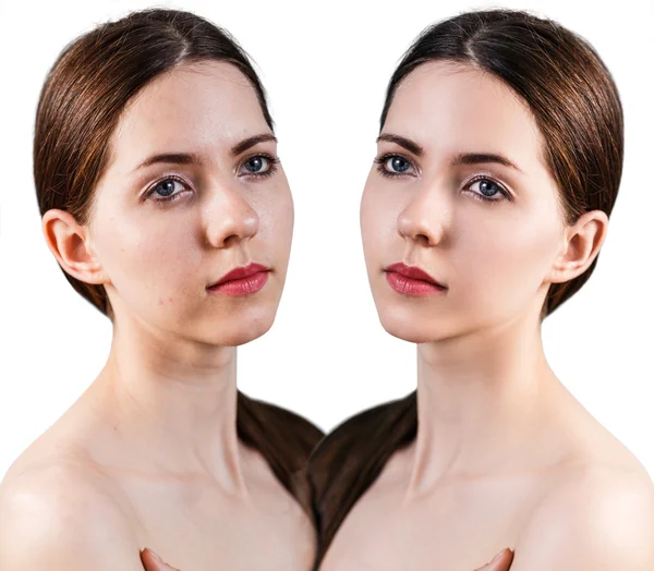 Mulher com problema de pele no rosto — Fotografia de Stock