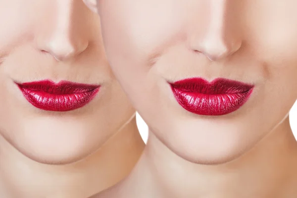 Red lips before and after filler injections — Stock Photo, Image