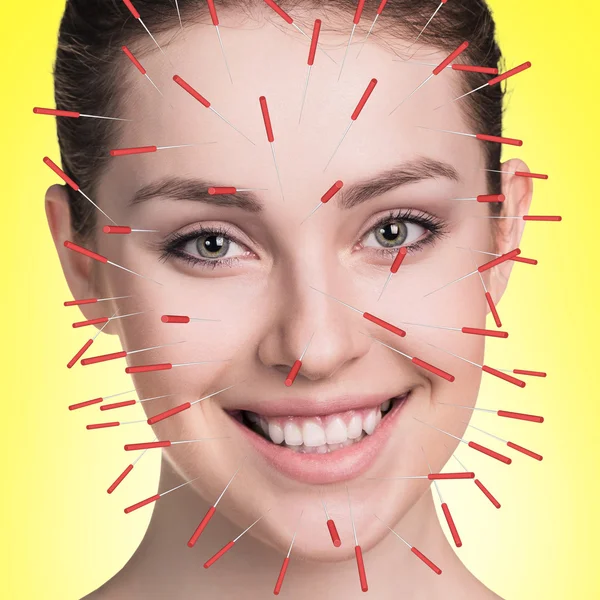 Teljesítő akupunktúrás kezelés arc részlete — Stock Fotó