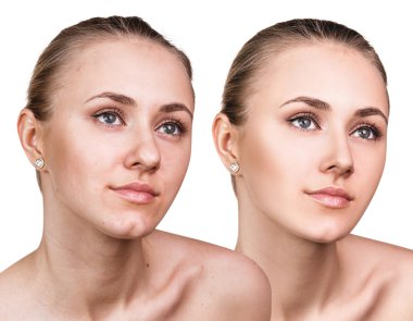 Sorun cilt yüzünde kadınla