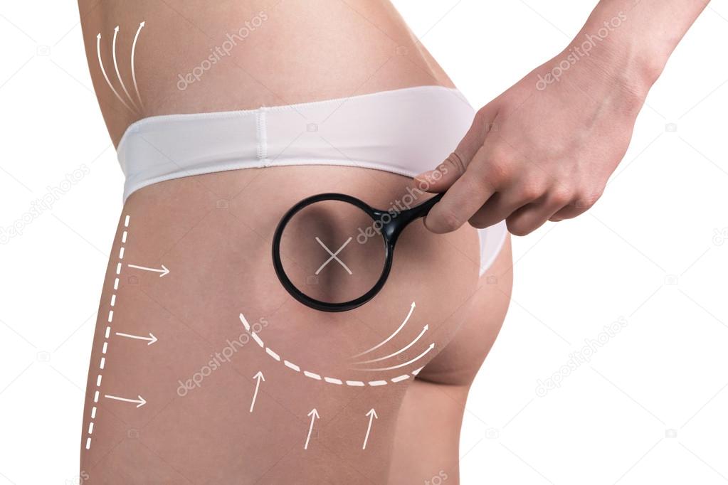 Body correction with help of plastic surgery