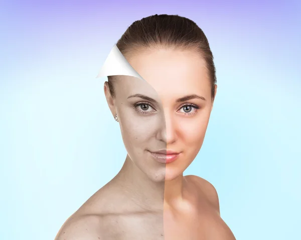 Young woman skin care concept. — Stock Photo, Image