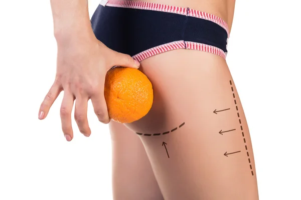 Body with cellulitis and orange fruit — Stock Photo, Image
