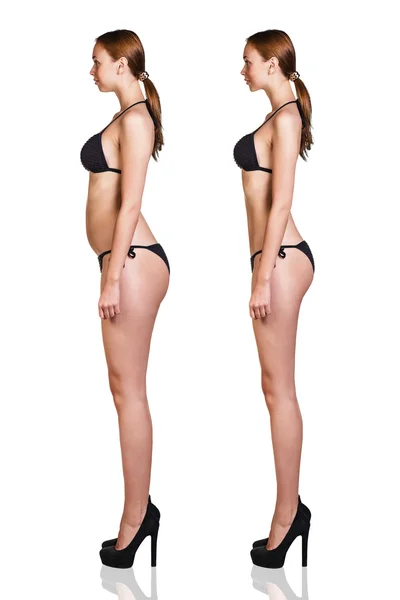 Mujer antes y después de perder peso — Foto de Stock