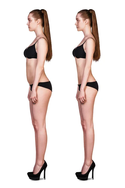 Mujer antes y después de perder peso — Foto de Stock