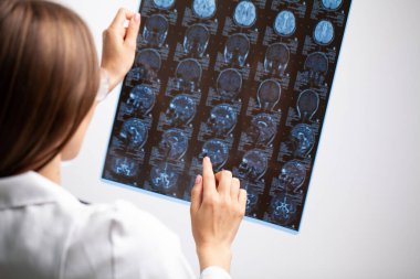 Güzel kadın radyoloji uzmanı MRI görüntülerine bakıyor.