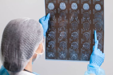 Güzel kadın radyoloji uzmanı MRI görüntülerine bakıyor.