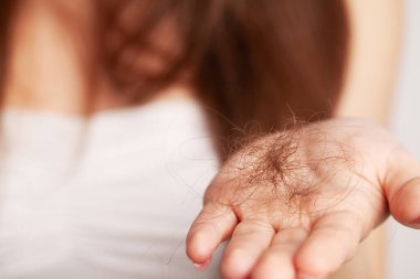 Saç dökülmesinden korkan genç bir kadın.