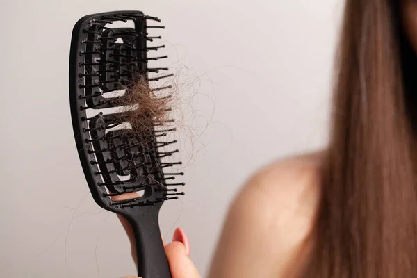 Young woman with comb worried about hair loss