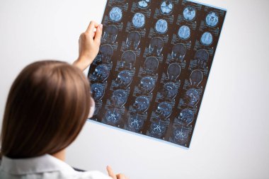 Güzel kadın radyoloji uzmanı MRI görüntülerine bakıyor.