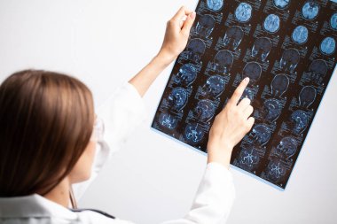 Güzel kadın radyoloji uzmanı MRI görüntülerine bakıyor.