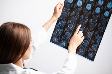 Doktor hastanın MR görüntüsünü inceliyor.