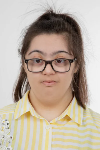 Retrato Menina Com Síndrome Estúdio — Fotografia de Stock