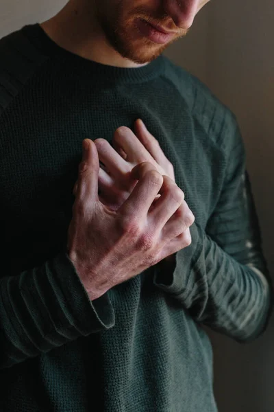 男性のかゆみを閉じ、手で引っかきます。手に乾癬または湿疹。赤い斑点のあるアトピー性アレルギー皮膚。男は自分自身を. — ストック写真