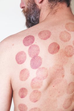 Can izleri adam geri Masaj