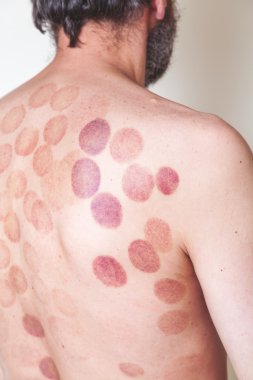 Can izleri adam geri Masaj