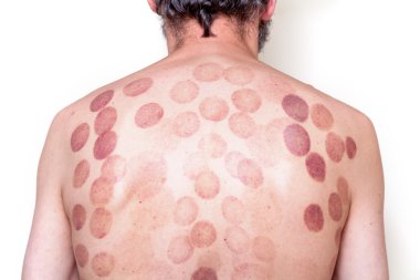 Can izleri adam geri Masaj