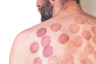 Can izleri adam geri Masaj