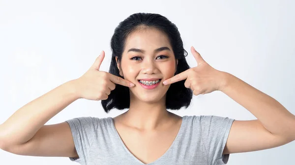 Asiatique Adolescent Facial Avec Des Bretelles Souriant Caméra Pour Montrer — Photo