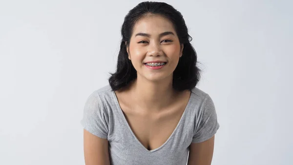 Oral Bakım Diş Teli Takan Genç Kız Gülümsüyor Kameraya Bakıyor — Stok fotoğraf