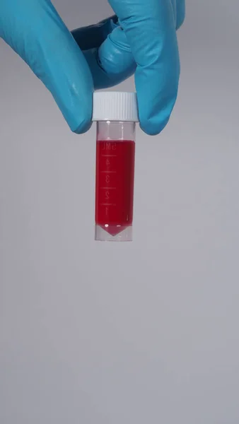 Blood tube. Covid 19 Test. doctor hand holding a blood sample tube for analysis in the lab background. Technician in medical gloves holding blood tube test for research vaccine protect virus infected.