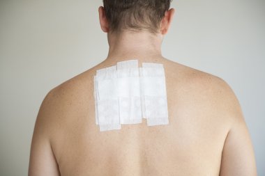 man back with allergy test clipart
