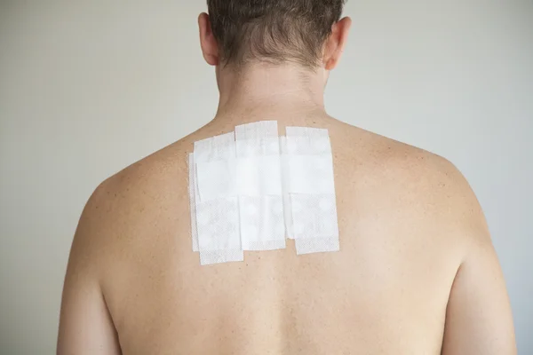 Adam geri alerji testi ile — Stok fotoğraf