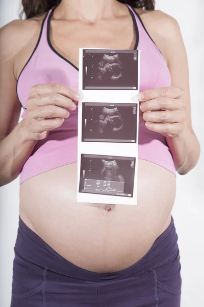 Pregnant with ultrasound baby scan — Zdjęcie stockowe