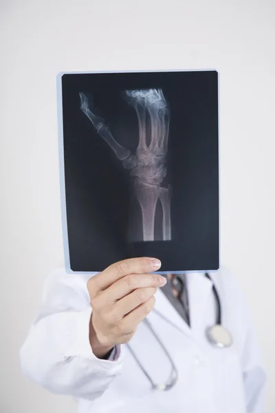 Läkare med radiografi — Stockfoto