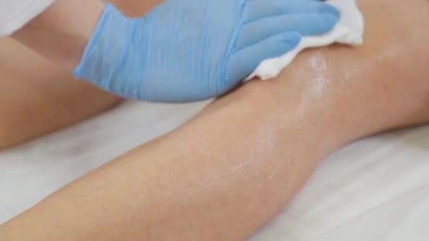 Профессиональный косметолог вытирает ноги после лазерной эпиляции. — стоковое видео