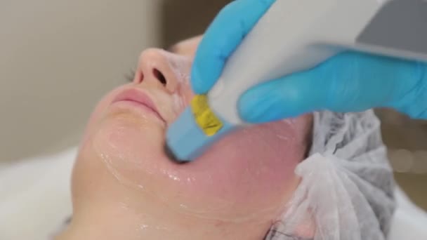 A kozmetikus nő lézerrel kezeli az arcát. Arcfiatalítás . — Stock videók