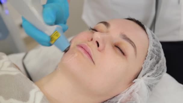 Femme esthéticienne faisant laser rajeunissement du visage. — Video