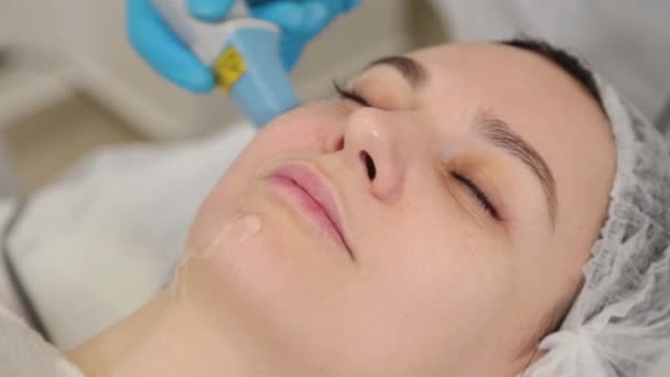 Vrouw schoonheidsspecialiste doet laser gezicht verjonging. — Stockvideo