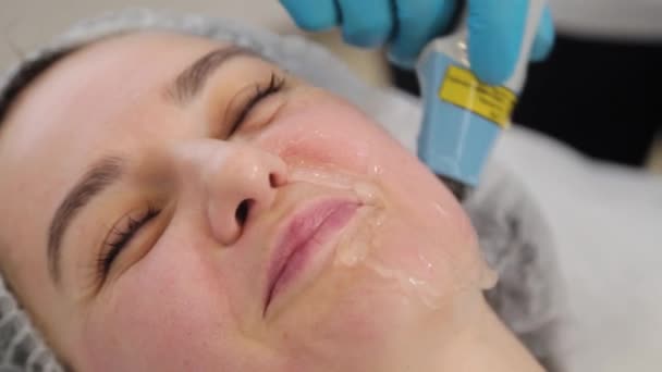 A kozmetikus nő lézerrel kezeli az arcát. Arcfiatalítás . — Stock videók