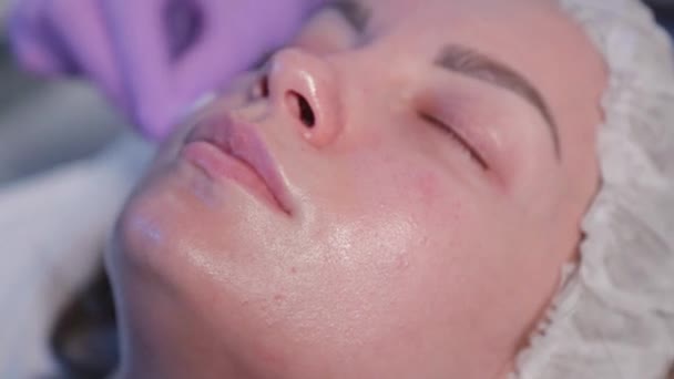 Vrouw schoonheidsspecialiste brengt vloeistof op vrouwen gezicht met wattenstaafjes. — Stockvideo