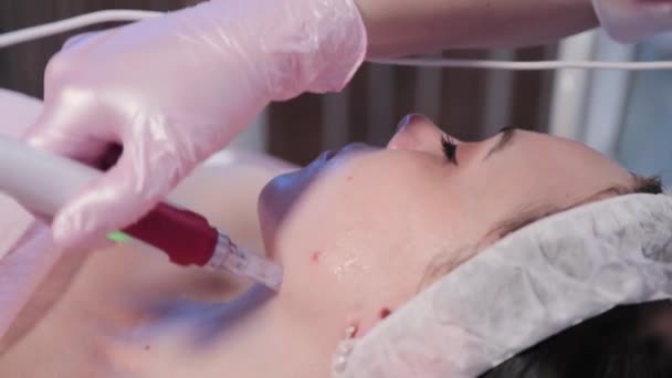Schoonheidsspecialiste doet mechanische peeling van het gezicht. — Stockvideo