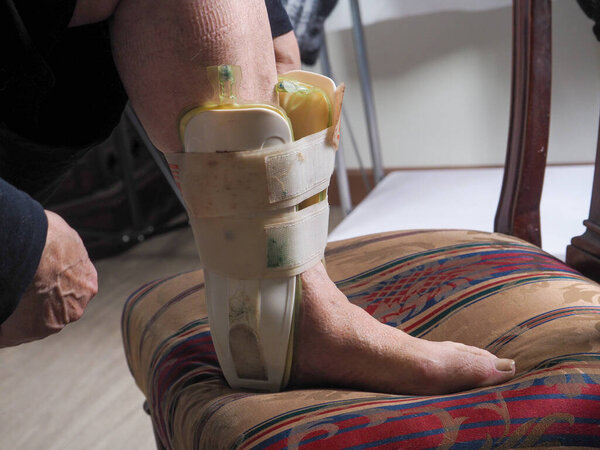 Close-up of an aged foot wearing a supportive medical brace, indicating recovery or mobility assistance needs