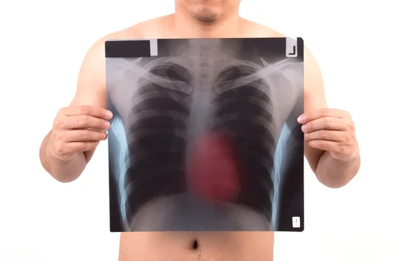 Unidentify person showing x-ray film — Stock Photo, Image