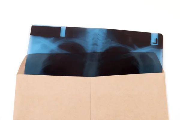 X-ray film of chest in brown envelope isolated — Stock Photo, Image