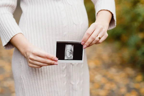 Mulher Grávida Feliz Com Notícias Gravidez Segurando Ultra Som Baby — Fotografia de Stock