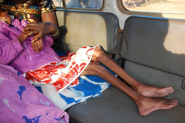 A little girl with the AIDS virus, and a strong malnutrition is — Stock Photo, Image