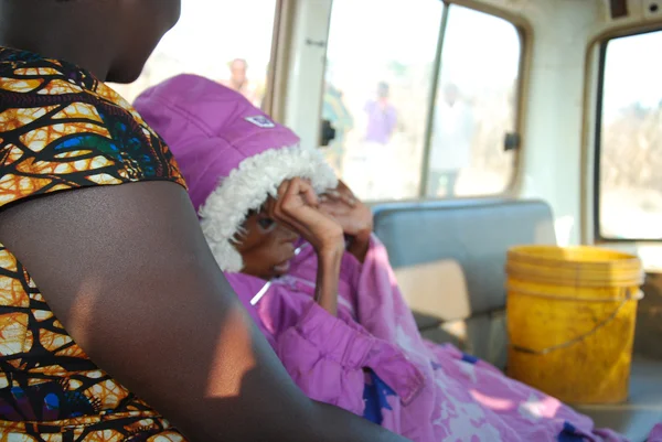 Маленькая девочка с вирусом СПИДа, и сильное недоедание — стоковое фото