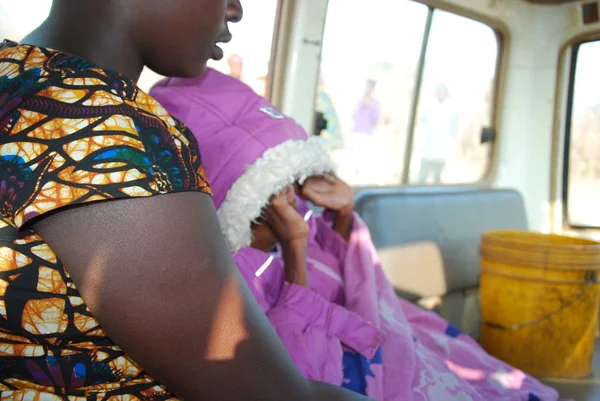 Una niña pequeña con el virus del SIDA, y una fuerte desnutrición es — Foto de Stock
