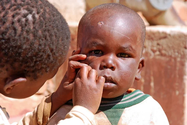 Niños africanos en Tanzania mientras te limpias la cara — Foto de Stock